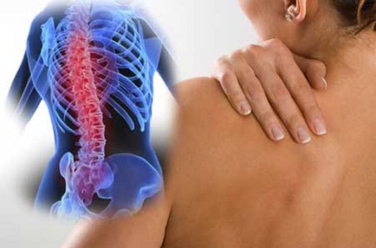 Osteokondroosiga võib valu kiirguda kaugematesse kehaosadesse