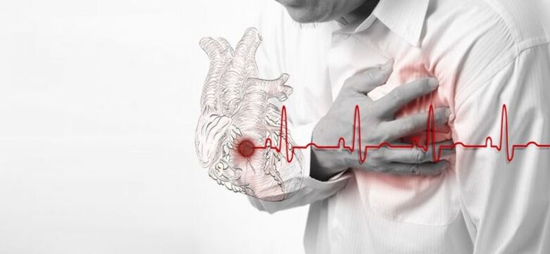 südameinfarkt kui valu põhjus vasaku abaluu all