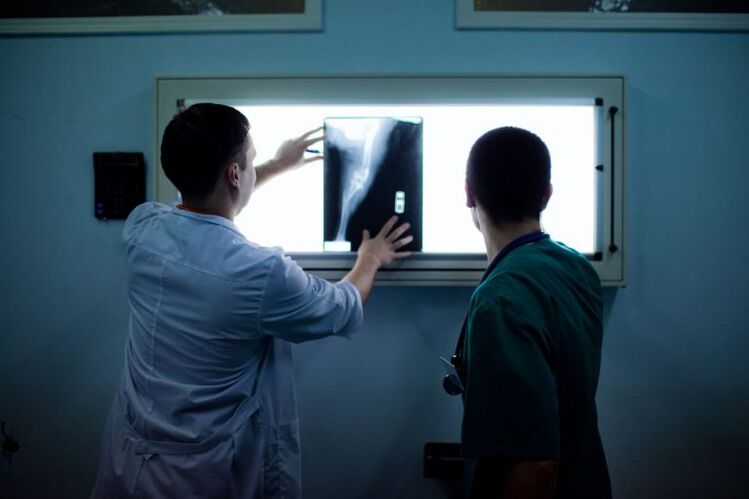 Artroosi diagnoosimine X -RAY -l